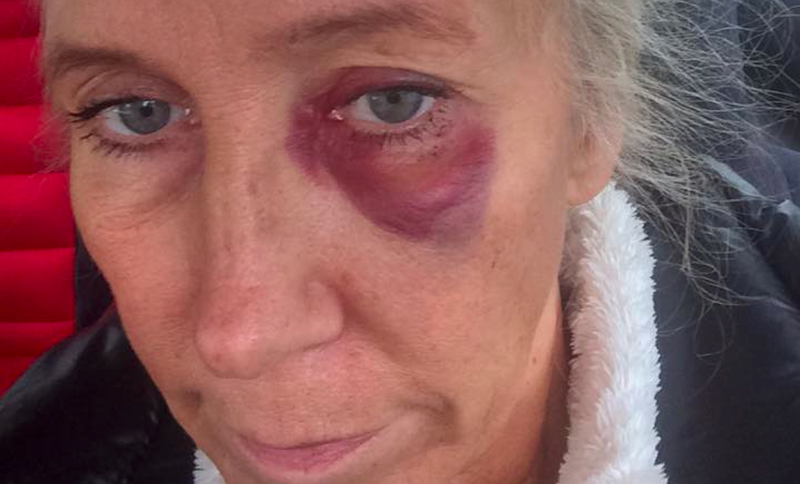 Katarina stoppade brutalt våldtäktsförsök – nu hyllas hon av tusentals