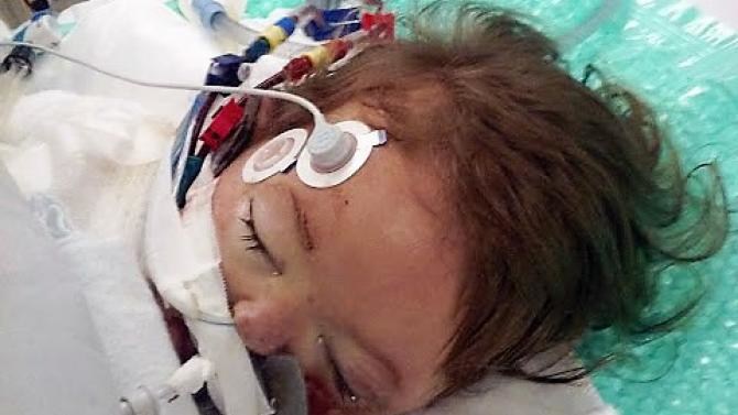 Mormor ville bada barnbarn i diskhon: Nu riskerar 2-årig flicka amputera armar och ben