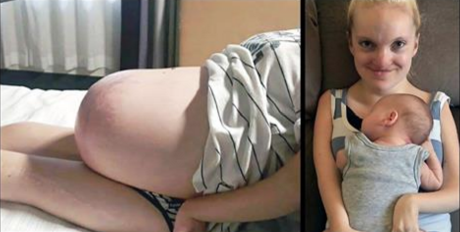 Hon har i stort sett inga muskler i kroppen – hennes mirakelbaby förvirrar läkarna