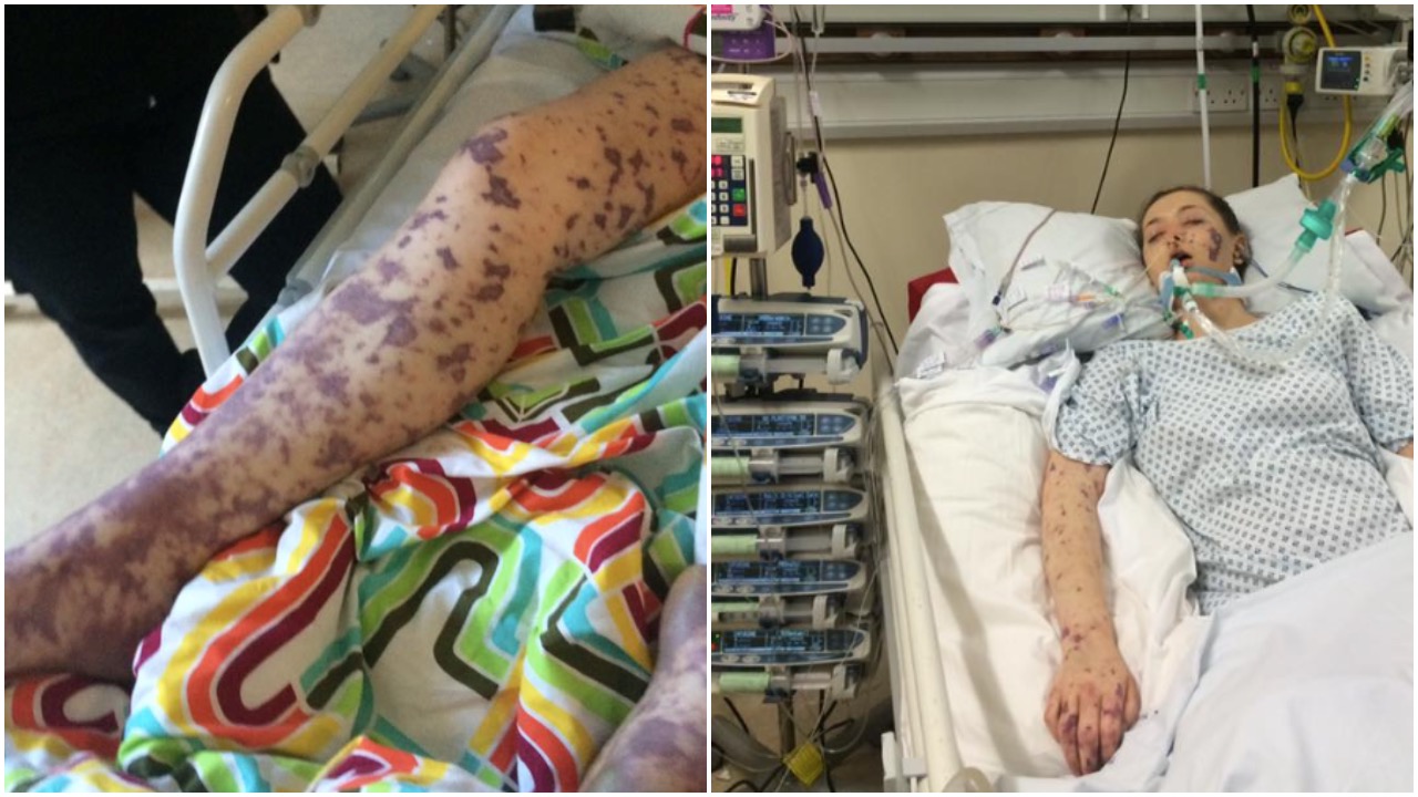 25-årig kvinna varnar med starka bilder: Akta dig för denna farliga sjukdom