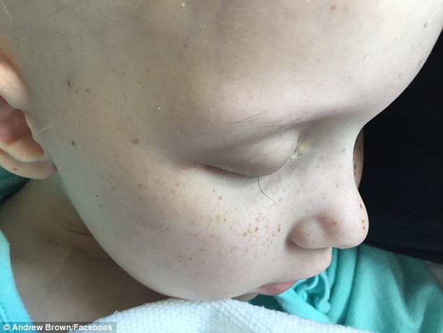 Foto av cancerdrabbad liten flickas sista ögonfransar är gripande