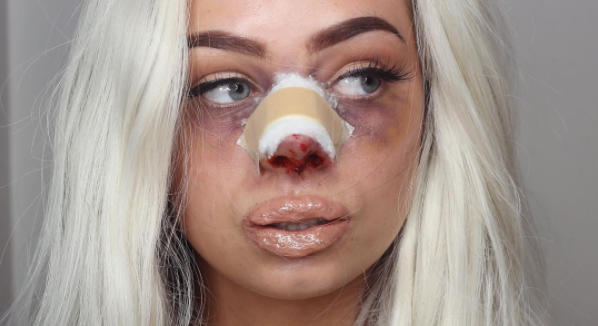 Karolina varnar unga tjejer med blodiga bilder: ‘Ser jag fin ut nu?’