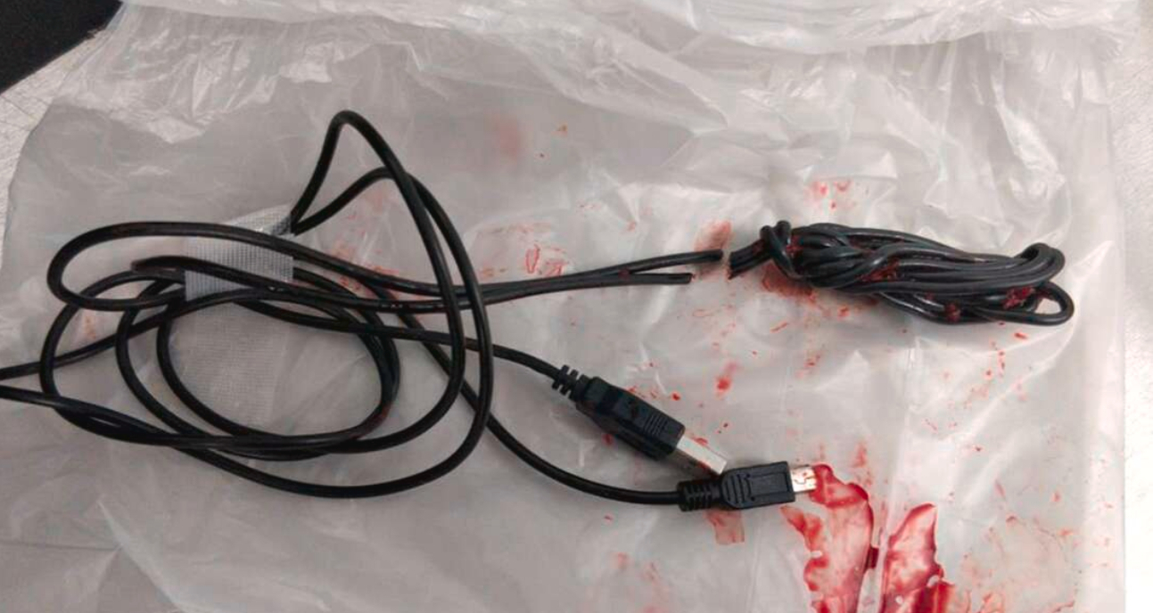 Tonåring var tvungen att opereras: Mätte insidan av sin penis med USB-kabel