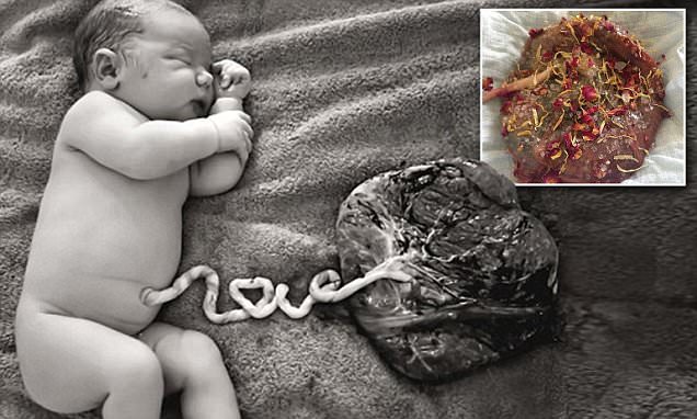 Läkare varnar för stigande trend hos nyblivna mammor