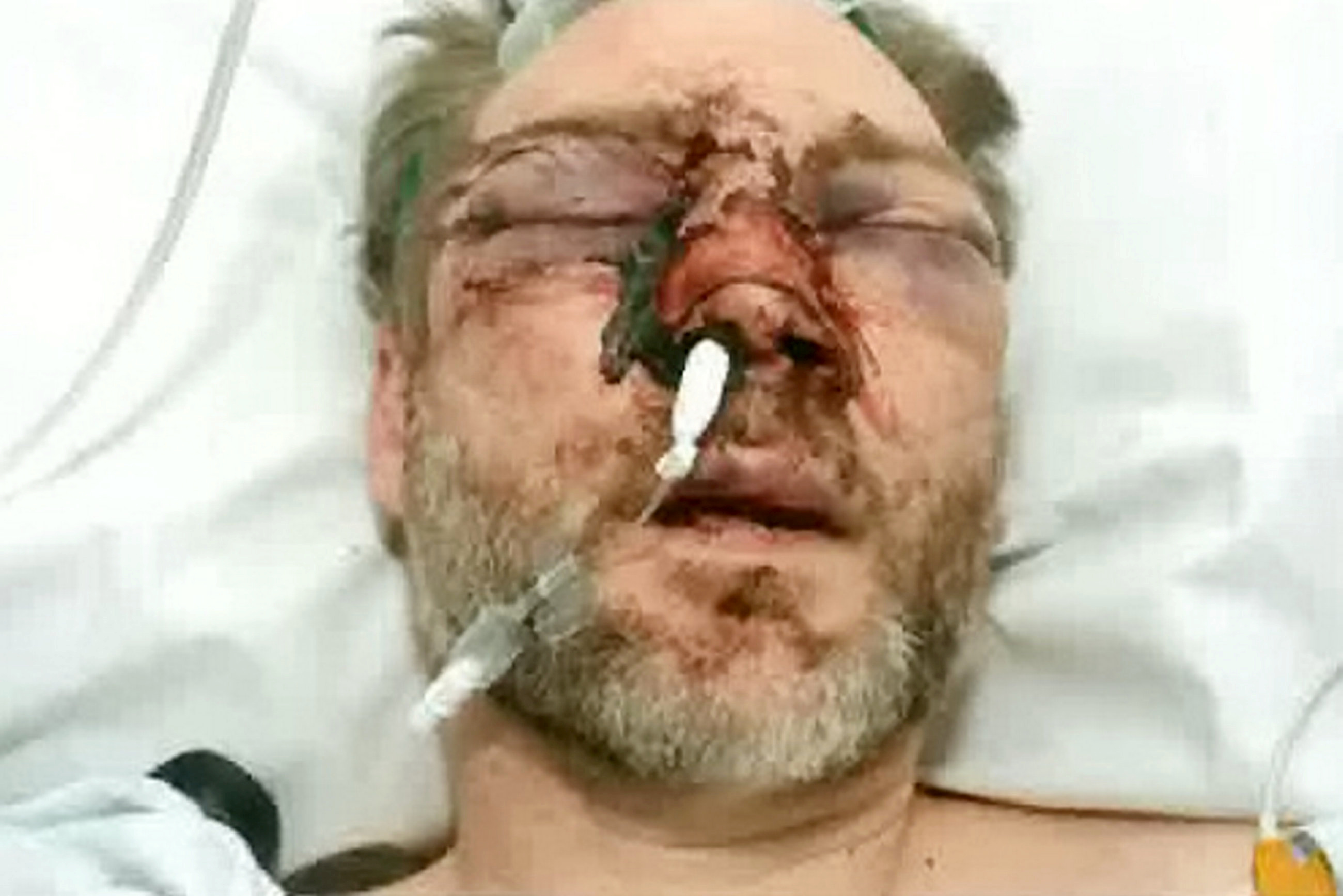 Läraren Christian krossad till oigenkännlighet: Då han hittade gärningsmannen på Facebook, gick sanningen upp för honom
