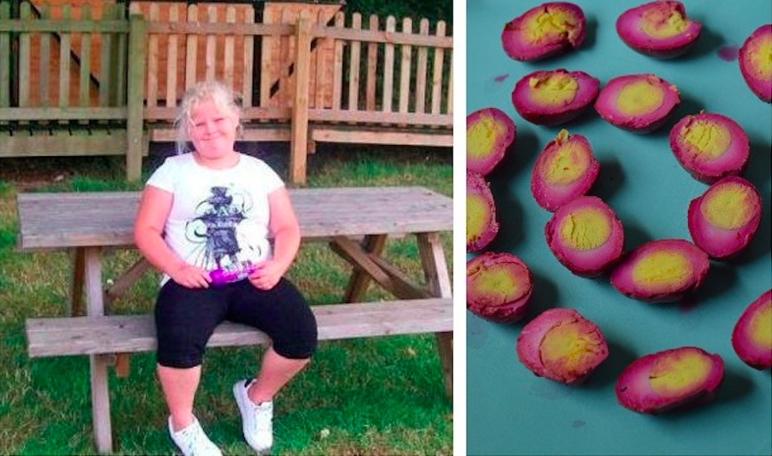 14-åriga Anna vägde 140 kilo och smygåt varje natt – kvävdes av sin favoriträtt