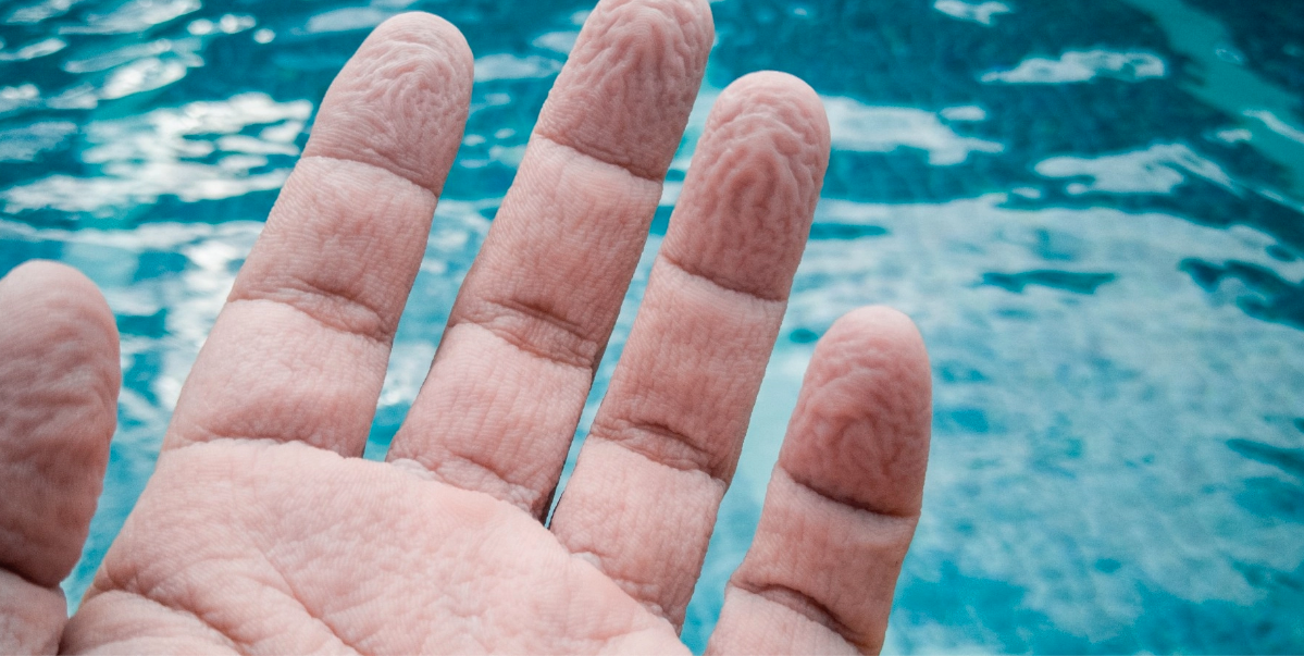 Få vet varför fingrarna blir rynkiga efter ett dopp i poolen eller stranden: Här är förklaringen