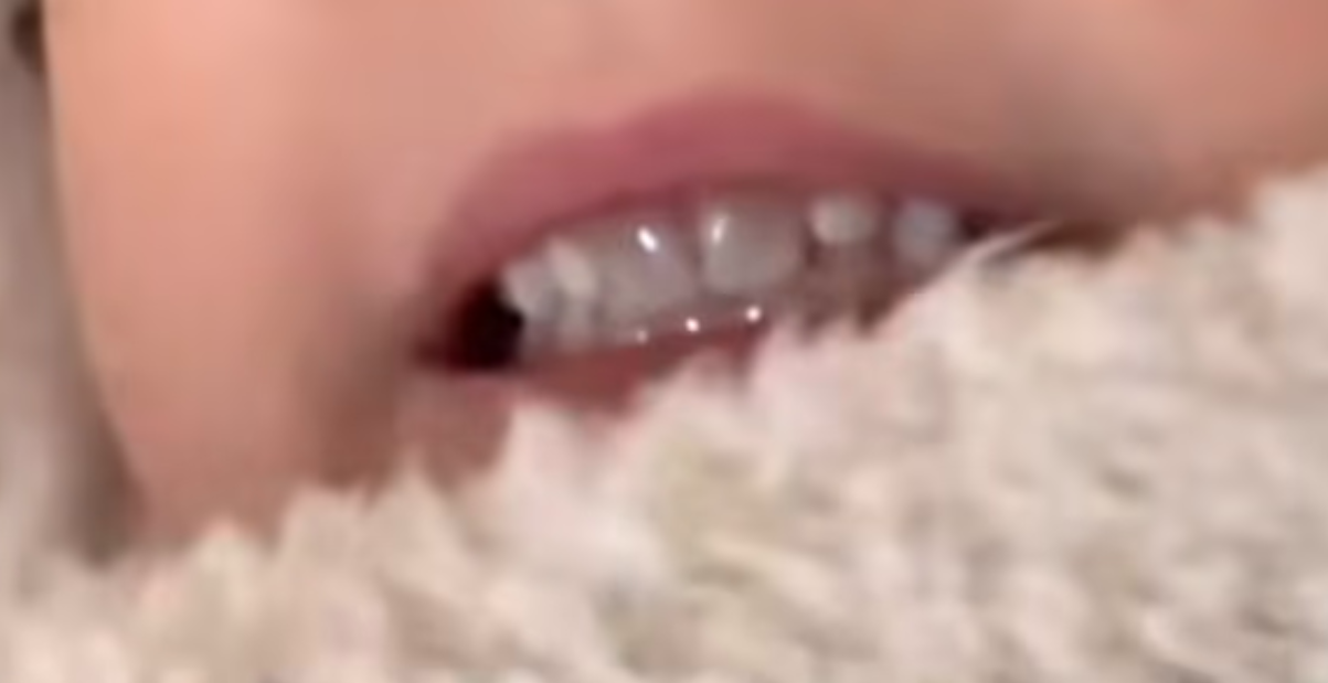 Skarp kritik mot influencer: Redigerade sin dotters tänder vitare