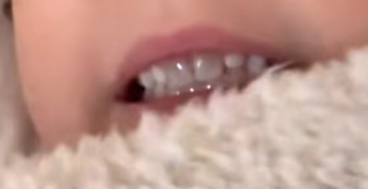 Skarp kritik mot influencer: Redigerade sin dotters tänder vitare
