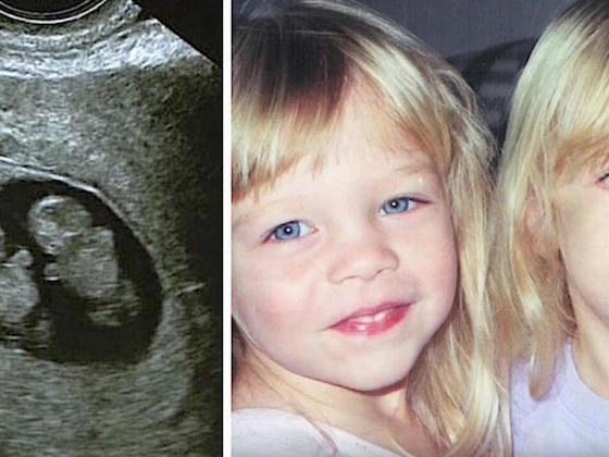 Mamma föder identiska tvillingar – 12 år senare hittar hon den ena dottern på badrumsgolvet